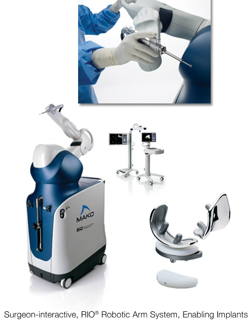 An Analysis of the Mako Surgical Robot – GW Chronicle of the Yawp